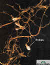 nodules-sec-roots.jpg 